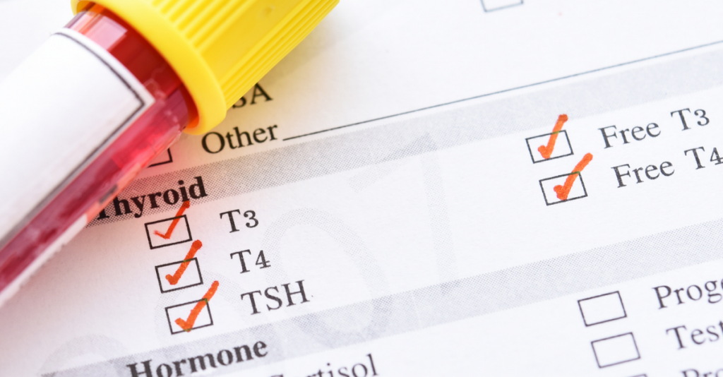 Normal Thyroid Test but Still Have Symptoms? When Testing Beyond TSH May Help